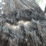 Before - Wide Normal